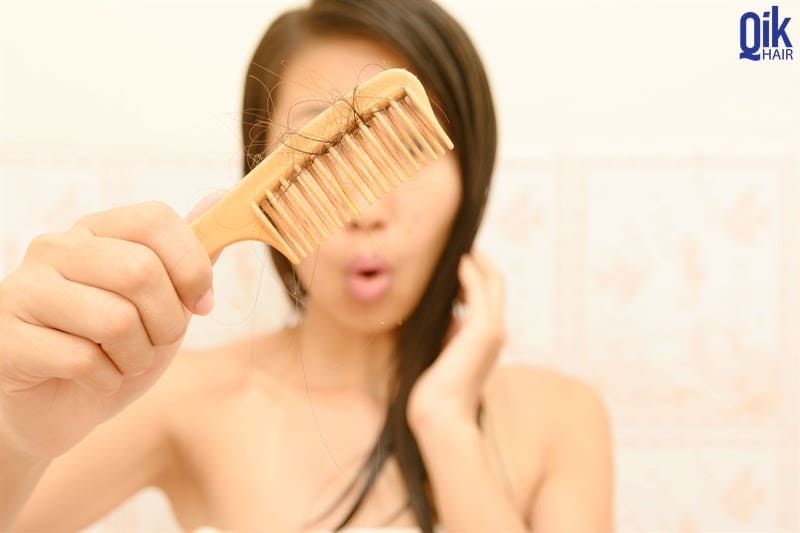 Bệnh rụng tóc: nguyên nhân và phương pháp cải thiện mọc tóc Biotin 10000 mcg lọ hộp 50 viên - Viên uống hỗ trợ ngăn rụng tóc, làm đẹp da
