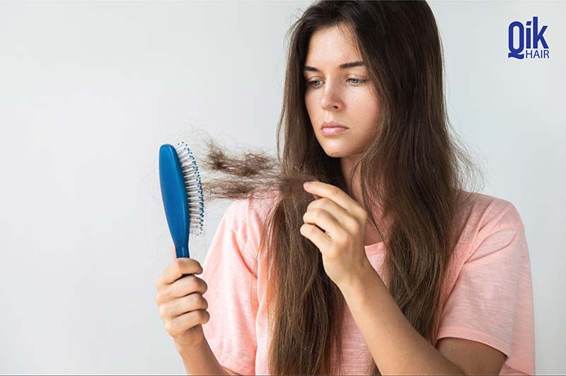 người bị rụng tóc