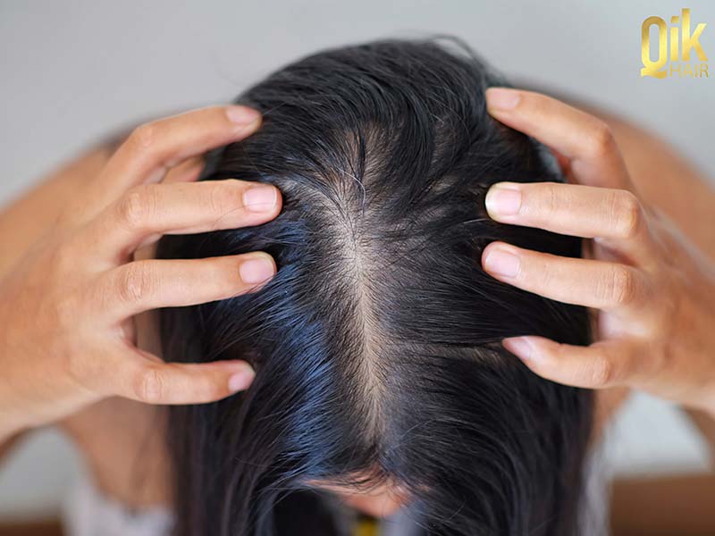 da đầu khô ngứa khó chịu