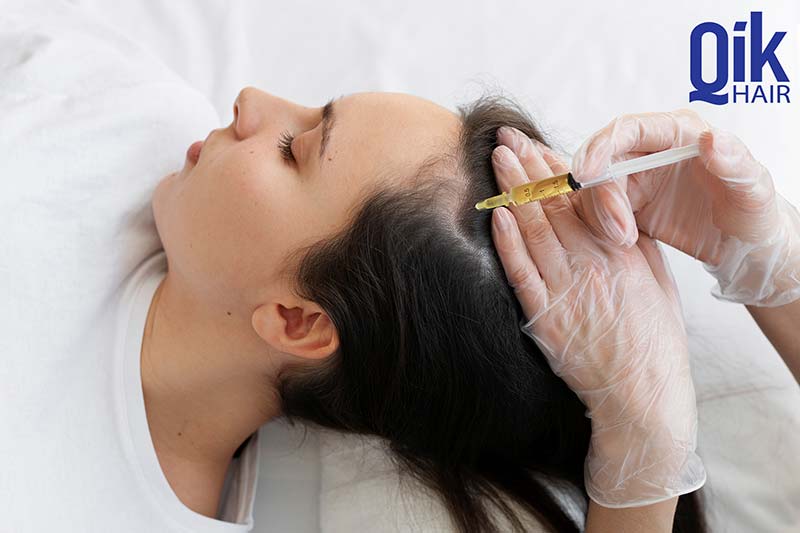 tiêm huyết tương giàu tiểu cầu khắc phục rụng tóc
