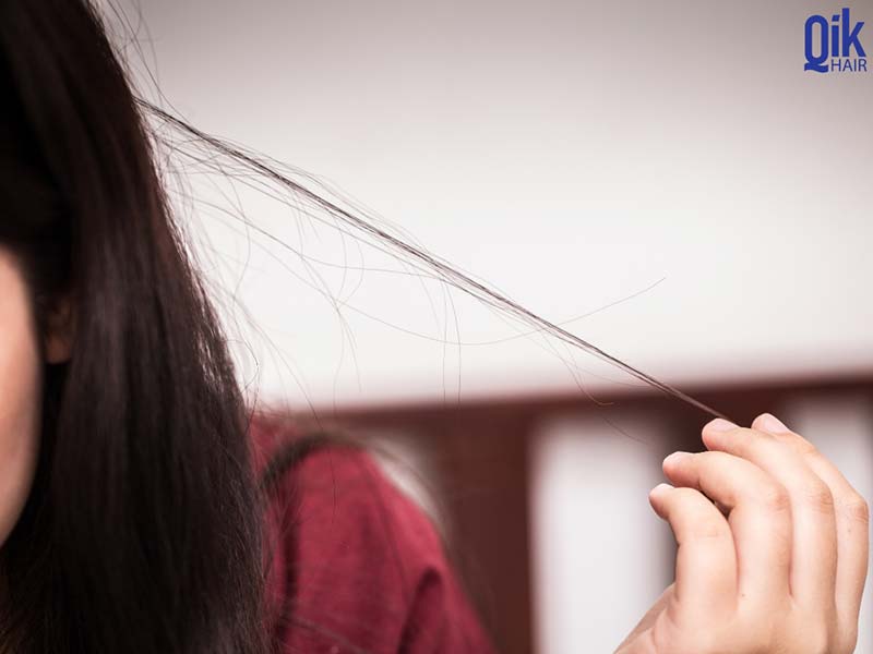 hội chứng nghiện giật tóc