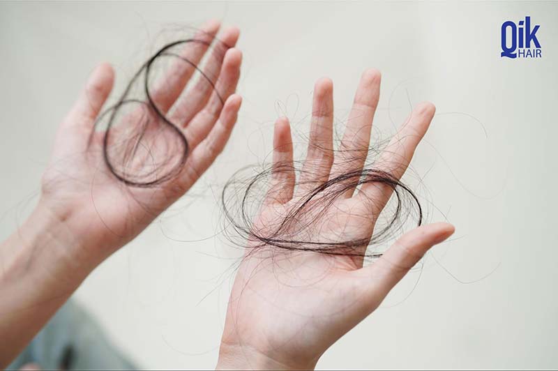tóc bị rụng nhiều