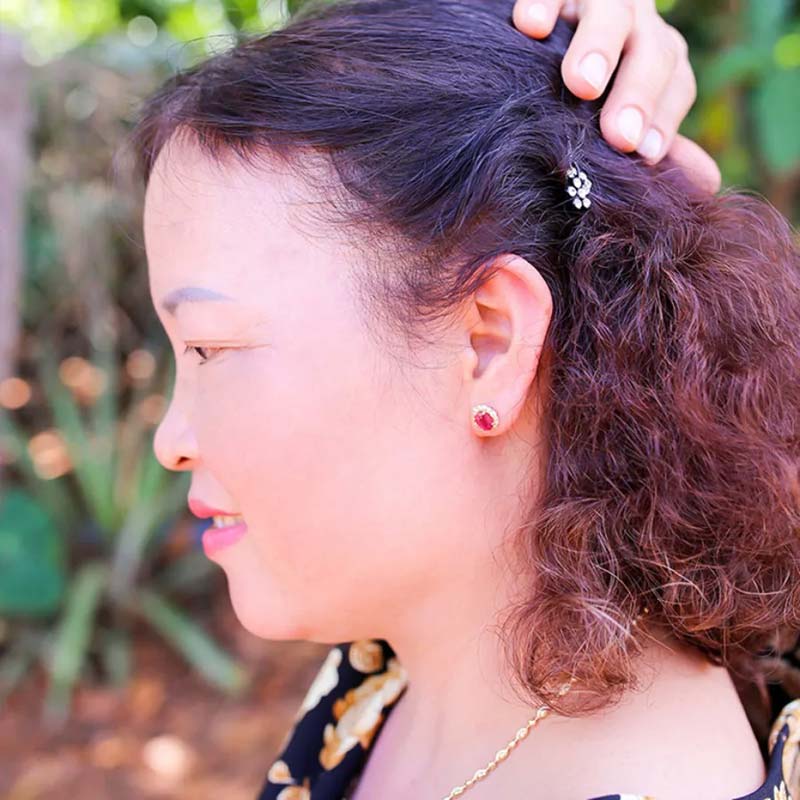 người phụ nữ mọc tóc đen