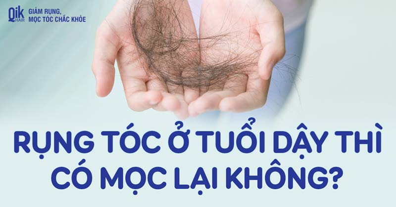 Rụng tóc ở tuổi dậy thì có mọc lại không? Làm sao để giảm rụng