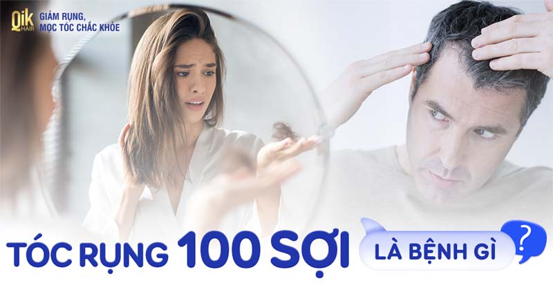 tóc rụng hơn 100 sợi là bệnh gì