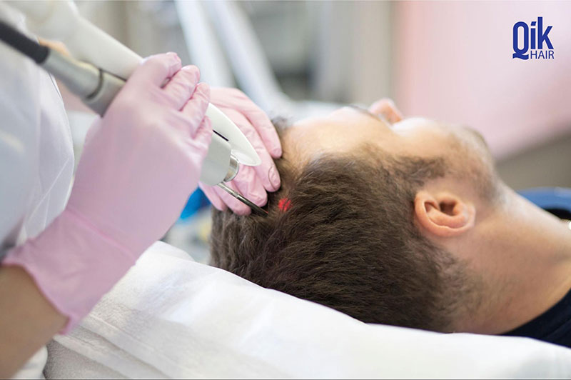 laser kích thích mọc tóc