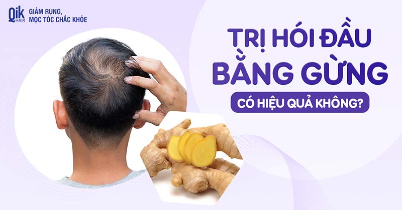Trị hói đầu bằng gừng có hiệu quả không? [Giải đáp chi tiết]