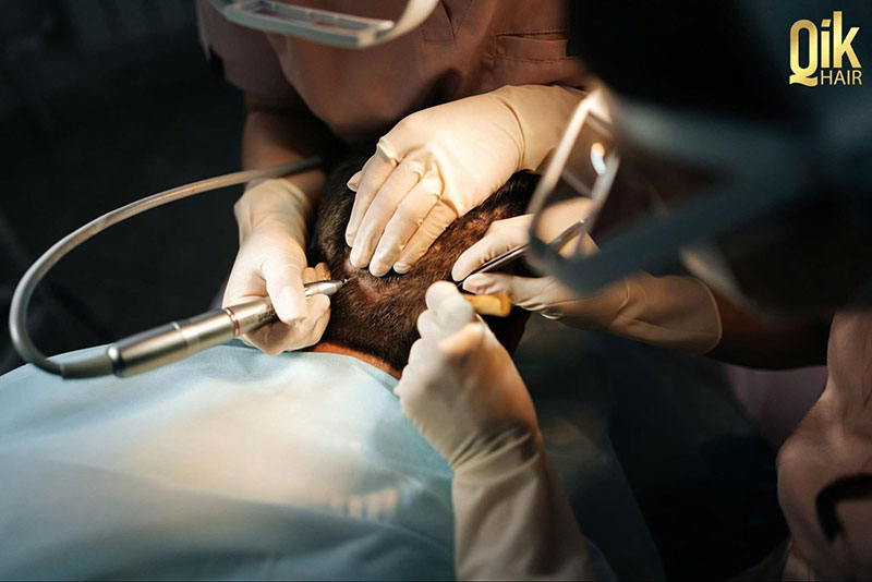 cấy tóc tự thân