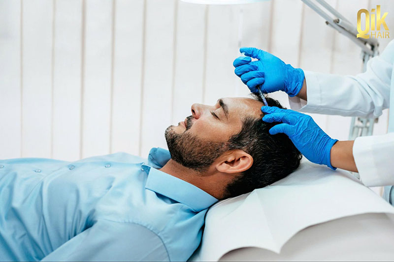 quy trình cấy tóc trị hói