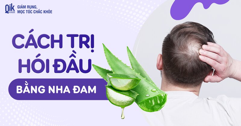 Trị hói đầu bằng nha đam có hiệu quả không? Hỗ trợ được gì?